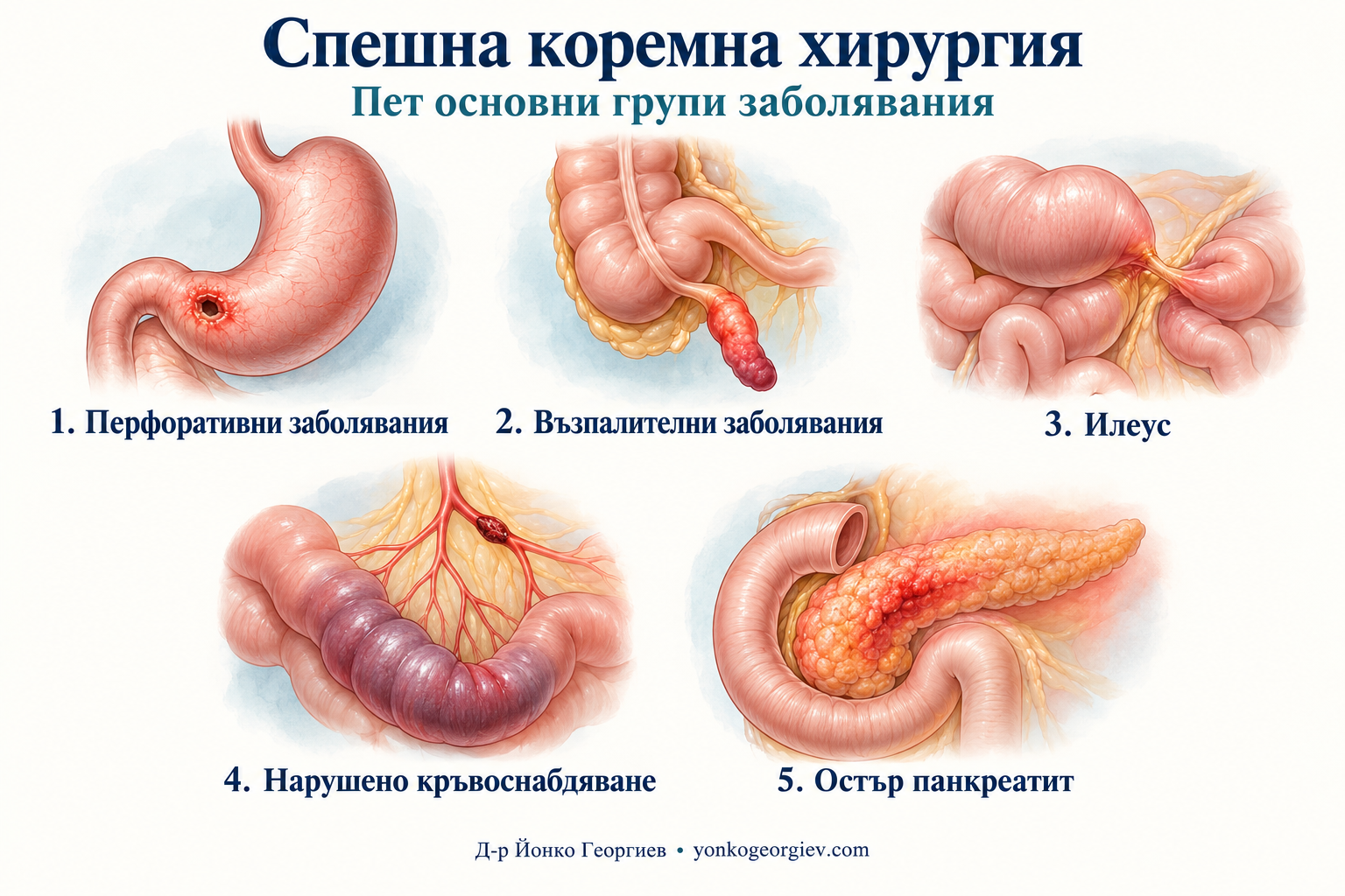 Спешна коремна хирургия: пет основни групи заболявания